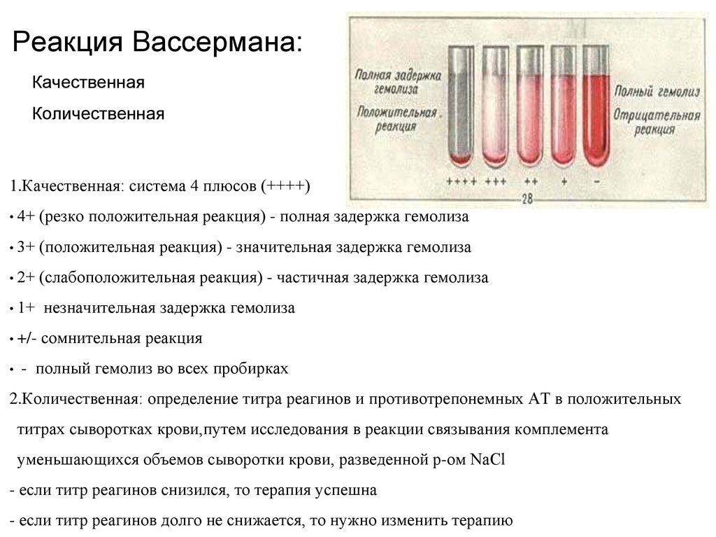 Антиген для реакции вассермана как применяется. Кровь на реакцию вассермана. Когда требуется проведение диагностики