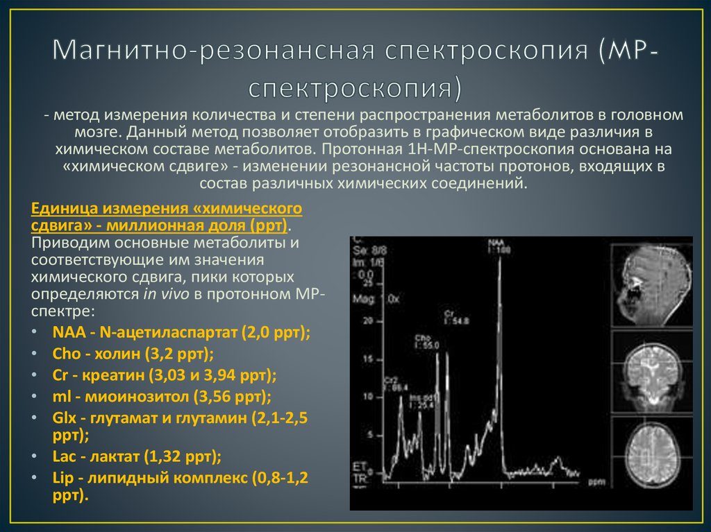 Магнитно резонансная протонная спектроскопия. Метод магнитно-резонансной (МР) спектроскопии головного мозга – что это такое. Электромагнитная совместимость с медицинской аппаратурой