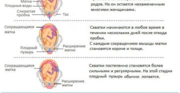 Сколько длятся схватки в самом начале. Как начинаются схватки у первородящих женщин? Признаки и ощущения при первых родах