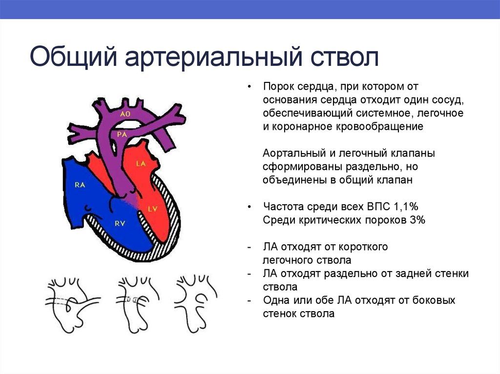 Общий артериальный ствол: описание, заболевания, лечение. Врожденные пороки сердца: общий артериальный ствол