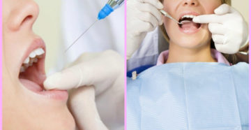 Удаление зуба при беременности. Что делать после удаления зуба при беременности. Можно ли во время беременности удалять зуб с использованием анестезии, на какой срок отложить операцию