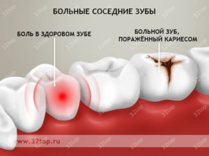 Почему к ночи начинает болеть зуб. Почему зубная боль усиливается только вечером и ночью в положении лежа, а днем — нет? Почему зубная боль усиливается только вечером и ночью в положении лежа, а днем - нет