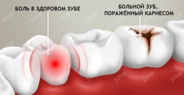 Почему к ночи начинает болеть зуб. Почему зубная боль усиливается только вечером и ночью в положении лежа, а днем — нет? Почему зубная боль усиливается только вечером и ночью в положении лежа, а днем - нет