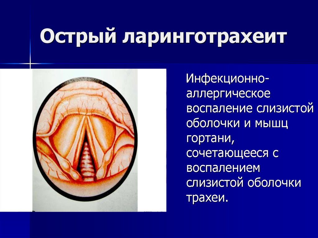 Инфекционный ларинготрахеит собак. Ларинготрахеит — воспаление гортани и трахеи у собак Прочие предрасполагающие факторы