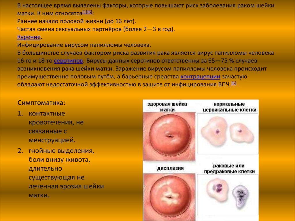 Спермотоксикоз у женщин как называется. Спермотоксикоз. Что это: серьезный диагноз или шуточный термин? Раннее начало половой жизни – норма