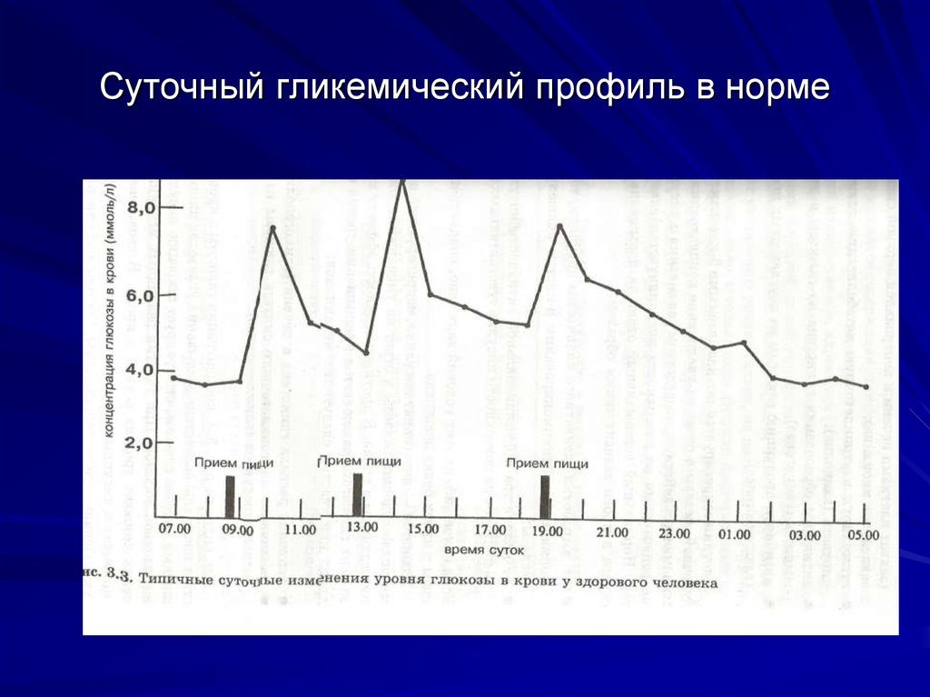 Гликемический профиль: норма. Анализ на гликемический профиль. Гликемический профиль - что это такое, нормы и отклонения