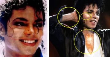 Почему майкл джексон был белым. Разрушаем мифы о Майкле Джексоне. Почему кожа Майкла Джексона побелела