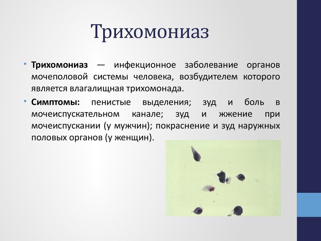 Трихомонадный простатит: откуда берутся трихомонады в простате и как от них избавиться? Трихомонадный простатит