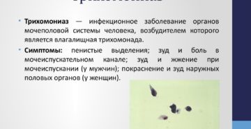 Трихомонадный простатит: откуда берутся трихомонады в простате и как от них избавиться? Трихомонадный простатит