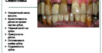 Кровоточивость десен и запах изо рта. Что делать, если кровоточат десна и неприятный запах изо рта даже после чистки зубов: причины и лечение. Почему кровоточат десна