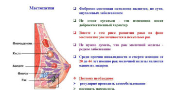 При нажатии на молочную железу чувствуется боль. Боль в молочной железе - причины появления, возможные заболевания, методы их диагностики и лечения