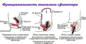 Укрепление сфинктера. Слабость сфинктера прямой кишки. Можно ли вылечить болезнь ЛФК