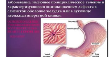 Что такое пролапс желудка. Симптомы и лечение пролапса слизистой желудка в пищевод. Признаки ГЭР, являющегося патологией