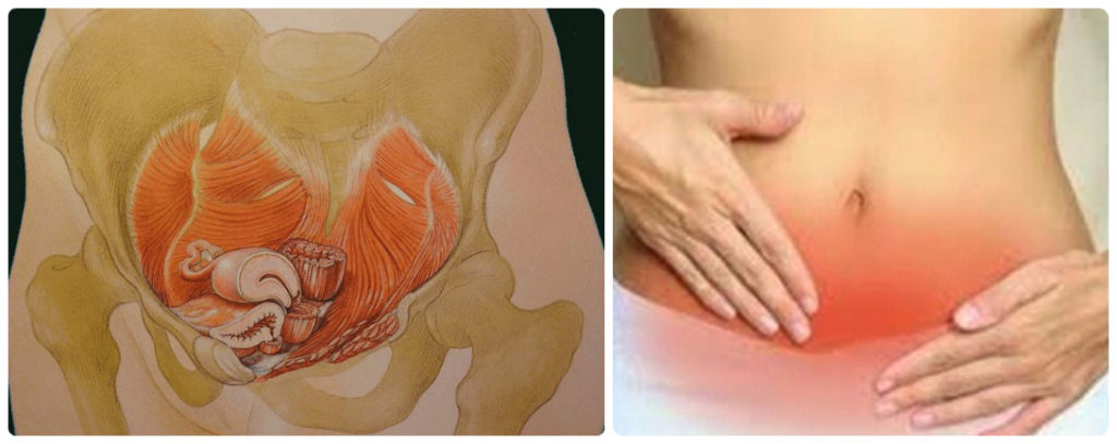 Что болит над лобковой костью у женщин. Боль в надлобковой области