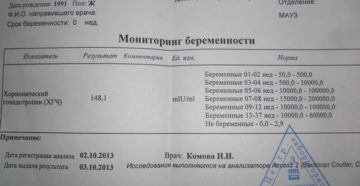 Анализ крови из пальца сколько делается. Сколько делается по времени анализ крови на хгч