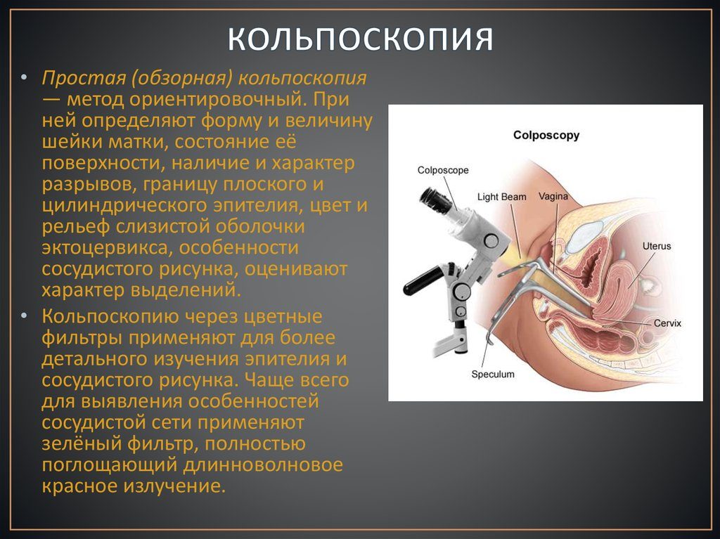 Сколько дней делается анализ после кольпоскопии. До и после кольпоскопии шейки матки: описание метода исследования