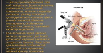 Сколько дней делается анализ после кольпоскопии. До и после кольпоскопии шейки матки: описание метода исследования