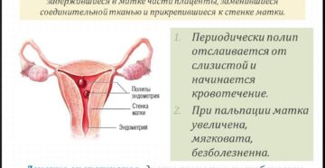 Что такое плацентарный полип после родов: симптомы, диагностика и лечение. Понятие и симптомы плацентарного полипа после родов и медаборта, особенности лечения