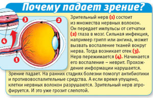 Сильно ухудшилось зрение что делать. Падает зрение: что делать? Народные средства