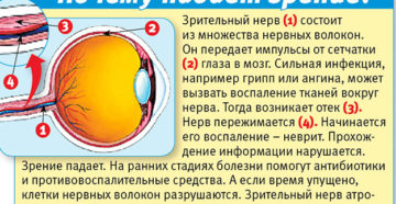 Сильно ухудшилось зрение что делать. Падает зрение: что делать? Народные средства