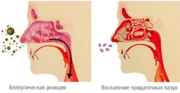 Постоянные выделения из носа по задней стенке. Диагностика слизи в горле: когда стоит обратиться к врачу? Причины стекания слизи по задней стенке горла