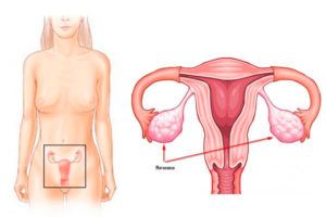 Левый яичник за маткой причины что делать. Женская матка: что это такое, как выглядит и где находится? Строение и физиологические изменения матки