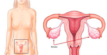 Левый яичник за маткой причины что делать. Женская матка: что это такое, как выглядит и где находится? Строение и физиологические изменения матки