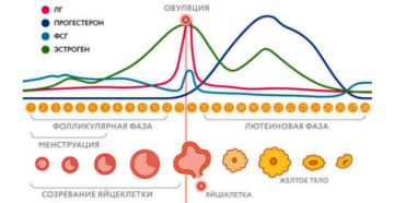 Причины сдвига цикла месячных. Симптомы нарушения менструального цикла