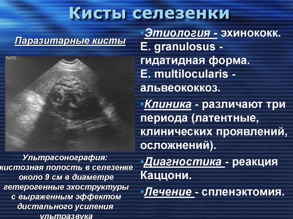 Воспаление селезенки: причины, симптомы, осложнения. Симптомы и лечение заболеваний селезенки у женщин и мужчин