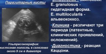 Воспаление селезенки: причины, симптомы, осложнения. Симптомы и лечение заболеваний селезенки у женщин и мужчин