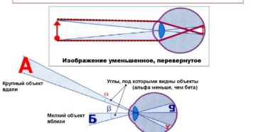 Построение изображения на сетчатке глаза. Глаз человека Какое изображение получается на сетчатке глаза