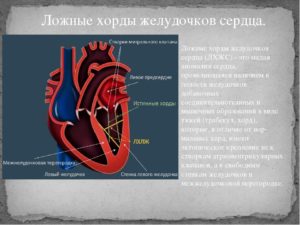 Малая аномалия сердца — трабекула левого желудочка: признаки и лечение. Дополнительная хорда в полости левого желудочка: причины и лечение