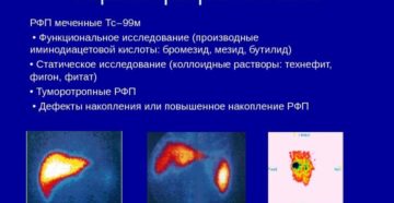 Сцинтиграфия печени: показания и противопоказания