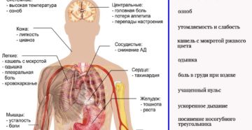 Почему и при каких обстоятельствах наступает смерть от пневмонии. Можно ли умереть от пневмонии и как не допустить летального исхода