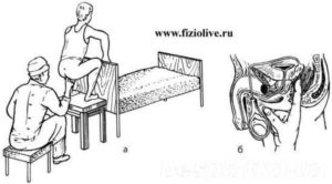 Как сделать массаж предстательной железы дома. Массаж простаты дома — за и против