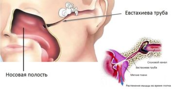 Треск в ухе при глотании причины. Хрустит в ухе при глотании и движении челюстью