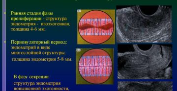 Как выходит эндометрий. Толстый эндометрий: строение, воздействие на организм, лечение