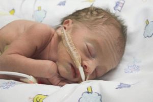 Причины, лечение и последствия менингита у новорожденных младенцев. Менингит у новорожденных детей