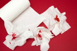 Во время туалета идет кровь. Причины появления крови на туалетной бумаге