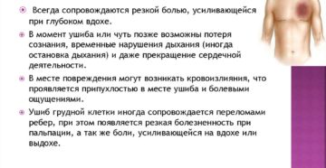 Сильный ушиб груди. Симптомы ушиба грудной клетки, лечение (в домашних условиях)