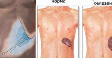Увеличенная селезенка у подростка. О чем кричит увеличенная селезенка у ребенка