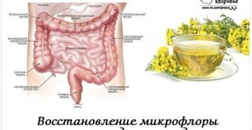 Как восстановить кишечник после долгого приема слабительных. Восстановление работы кишечника после операции. Пищеварительные ферменты для микрофлоры кишечника