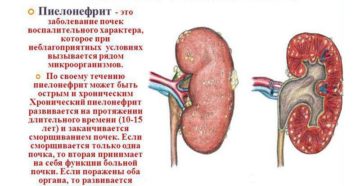 Пиелонефрит почек от чего бывает. Реабилитация после болезни. Причины возникновения пиелонефрита