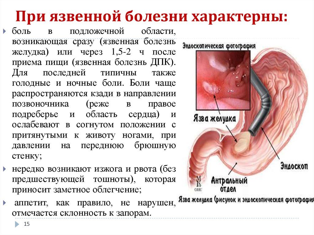 Ли подняться температура от желудка. Температура при гастрите, причины появления и способы борьбы с ней