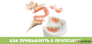 Привыкание к съемным зубным протезам: как облегчить адаптацию. Как быстрее привыкнуть к съемным зубным протезам