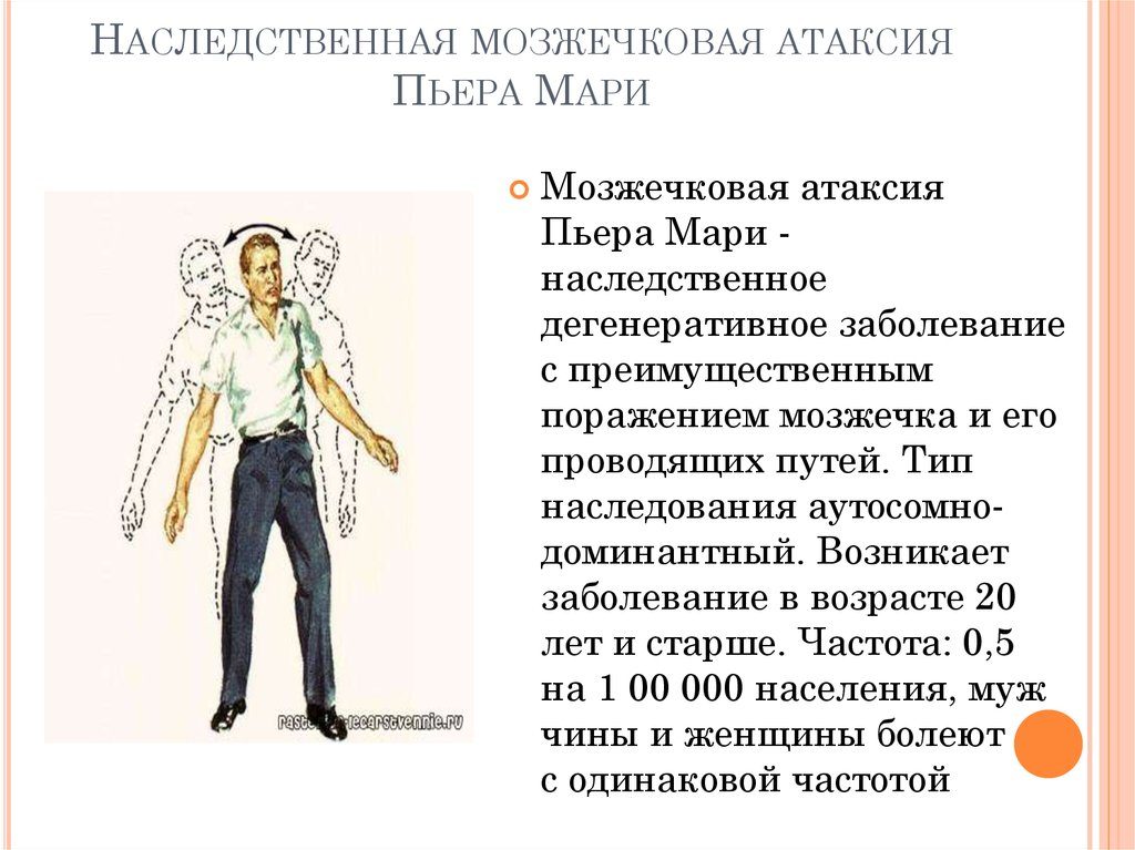 Наследственная атаксия пьера мари. Наследственная мозжечковая атаксия Пьера Мари: причины и симптомы. Симптомы и причины возникновения атаксии