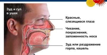 Причины и лечение постоянного зуда носа снаружи. Зуд в носу, чихание, насморк — о чем говорят симптомы