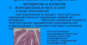 Энтерит у ребенка: диагностика и лечение. Энтерит у детей. Как лечить острый энтерит. Что важно сделать