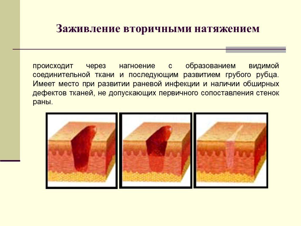 Не заживают раны на коже причины. Плохо заживают раны: причины. Общие принципы обработки