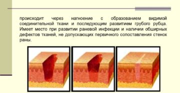 Не заживают раны на коже причины. Плохо заживают раны: причины. Общие принципы обработки